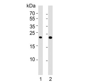 Western blot testing of human 1) brain and 2) kidney tissue lysate with FGF9 antibody. Predicted molecular weight ~23 kDa with a possible 45-55 kDa dimer.