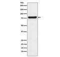 Western blot testing of human plasma lysate with Plasma Kallikrein antibody. Predicted molecular weight ~71 kDa.
