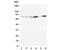 Western blot testing of MMP9 antibody and Lane 1: rat embryo; 2: MM453; 3: HeLa; 4: SMMC-7721; 5: Jurkat; 6: HT1080. Predicted molecular weight: 92/67-80 kDa (precursor/mature forms).