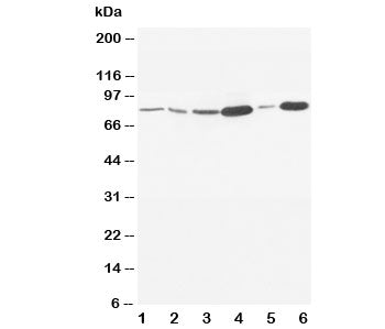 Western blot testing of MMP9 antibody and Lane 1: rat embryo; 2: MM453; 3: HeLa; 4: SMMC-7721; 5: Jurkat; 6: HT1080. Predicted molecular weight: 92/67-80 kDa (precursor/mature forms).
