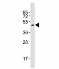Western blot testing of Smad3 antibody at 1:2000 dilution + rat brain lysate; Observed molecular weight: 48~55 kDa.