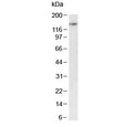 Western blot testing of mouse testis tissue lysate with BRD4 antibody at 1ug/ml. Predicted molecular weight ~156 kDa (long form, can be observed at 200+ kDa) and ~81 kDa (short form).
