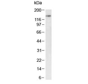 Western blot testing of mouse testis tissue lysate with BRD4 antibody at 1ug/ml. Predicted molecular weight ~156 kDa (long form, can be observed at 200+ kDa) and ~81 kDa (short form).
