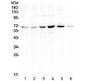 Western blot testing of human 1) HeLa, 2) U-87 MG, 3) COLO320, 4) HepG2, 5) rat brain and 6) mouse NIH3T3 lysate with PIAS3 antibody at 0.5ug/ml. Predicted molecular weight ~68 kDa.
