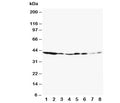 Western blot testing of ERK1 antibody and Lane 1: rat spleen; 2: rat thymus; 3: rat skeletal muscle; 4: rat kidney; 5: HeLa; 6: Jurkat; 7: Raji; 8: COLO320. Predicted molecular weight: ~44 kDa.