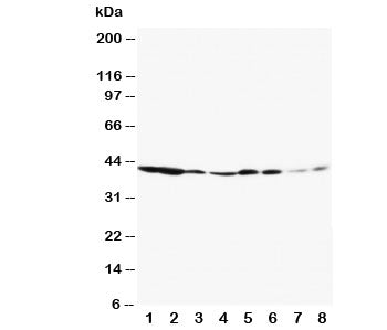 Western blot testing of ERK1 antibody and Lane 1: rat spleen; 2: rat thymus; 3: rat skeletal muscle; 4: rat kidney; 5: HeLa; 6: Jurkat; 7: Raji; 8: COLO320. Predicted molecular weight: ~44 kDa.