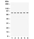 Western blot testing of 1) rat heart, 2) rat kidney, 3) rat brain, 4) human SMMC, 5) human PANC and 6) human A549 lysate with TRAP1 antibody. Expected molecular weight: 75-80 kDa.
