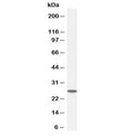 Western blot testing of human HeLa cell lysate with GSTM4 antibody at 0.1ug/ml. Predicted molecular weight ~26 kDa.