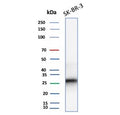 Western blot testing of human SK-BR-3 cell lysate with recombinant CDKN1B antibody (clone rCDKN1B/13245). Commonly observed at ~27 kDa.