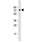 Western blot testing of human HeLa cell lysate with BANP antibody at 1:1000. Predicted molecular weight: 56 kDa, observed here at ~70 kDa.