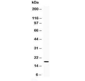 Western blot testing of 0.5ng/lane of human IFNg recombinant protein with human Interferon gamma antibody at 0.5ug/ml.