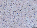 IHC staining of FFPE mouse brain tissue with Semaphorin-4F antibody. HIER: boil tissue sections in pH8 EDTA for 20 min and allow to cool before testing.