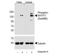 Western blot analysis of lysates from human HeLa and Jurkat cell lines, untreated or treated with Calyculin A (100nM), using phospho-MYPT1 antibody (upper) or Tubulin Ab (lower).