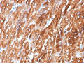 IHC staining of FFPE human heart tissue with Crystallin Alpha B antibody (clone CRYAB/7918). HIER: boil tissue sections in pH 9 10mM Tris with 1mM EDTA for 20 min and allow to cool before testing.