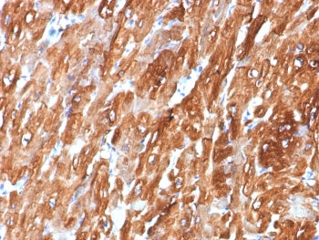 IHC staining of FFPE human heart tissue with Crystallin Alpha B antibody (clone CRYAB/7918). HIER: boil tissue sections in pH 9 10mM Tris with 1mM EDTA for 20 min and allow to cool before testing.