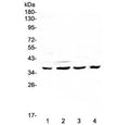 Western blot testing of human 1) HeLa, 2) SGC-7901, 3) K562 and 4) mouse SP2/0 lysate with Cdk6 antibody at 0.5ug/ml. Expected molecular weight: 36-40 kDa.