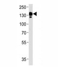 Ceruloplasmin antibody western blot analysis in human blood plasma lysate. Predicted molecular weight ~130 kDa.