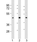 Western blot testing of human 1) HepG2, 2) MCF-7 and 3) PC-3 cell lysate with SAPCD2 antibody at 1:2000. Predicted molecular weight: 43 kDa.