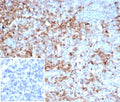 IHC staining of FFPE human tonsil tissue with SERPINA1 antibody (clone AAT/6325). Inset: PBS used in place of primary Ab (secondary Ab negative control). HIER: boil tissue sections in pH 9 10mM Tris with 1mM EDTA for 20 min and allow to cool before testing.