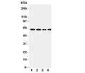 Western blot testing of LCAT antibody and Lane 1: rat brain; 2: U87; 3: HeLa; 4: SMMC-7721 cell lysate. Observed size 50~75KD, depending on glycosylation level.