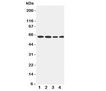Western blot testing of LCAT antibody and Lane 1: rat brain; 2: U87; 3: HeLa; 4: SMMC-7721 cell lysate. Observed size 50~75KD, depending on glycosylation level.