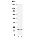 Western blot testing of IL1 beta antibody and Lane 1: recombinant human partial protein 20ng; 2: 10ng
