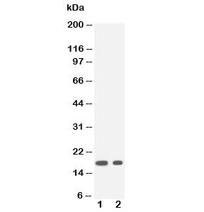 Western blot testing of IL1 beta antibody and Lane 1: recombinant human partial protein 20ng; 2: 10ng