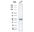 Western blot testing of human liver tissue lysate using AKR1C1 antibody (clone AKR1C1/9063). Predicted molecular weight ~37 kDa.