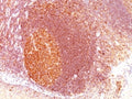 IHC: Formalin-fixed, paraffin-embedded human tonsil stained with MALT1 antibody (clone SPM578).