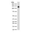 Western blot testing of human spleen lysate with CD68 antibody (clone CDLA68-3R). Expected molecular weight: 37-110 kDa depending on glycosylation level.