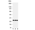 Western blot testing of FGF19 antibody and Lane 1: rat brain; 2: human U87; 3: human SMMC-7721 cell lysate. Predicted molecular weight ~24 kDa.