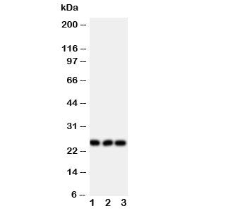 Western blot testing of FGF19 antibody and Lane 1: rat brain; 2: human U87; 3: human SMMC-7721 cell lysate. Predicted molecular weight ~24 kDa.