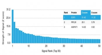 Analysis of a HuProt(TM) microarray containing more than 19,000 full-length human proteins using Secretogranin I antibody (clone CHGB/4560). Z- and S- Score: The Z-score represents the strength of a signal that a monoclonal antibody (in combination with a fluorescently-tagged anti-IgG secondary antibody) produces when binding to a particular protein on the HuProt(TM) array. Z-scores are described in units of standard deviations (SD's) above the mean value of all signals generated on that array.