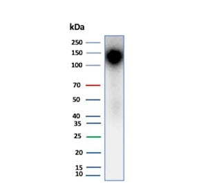 Western blot testing of human kidney tissue lysate using recombinant Ksp-Cadherin antibody (clone rCDH16/7343). Expected molecular weight ~130 kDa.