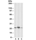 Western blot testing of human [A], mouse [B], rat [C] liver lysate with ABHD14B antibody at 0.3ug/ml. Predicted molecular weight: ~22kDa.