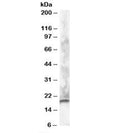 Western blot testing of human brain lysate with CABP1 antibody at 1ug/ml. Predicted molecular weight: ~26/19kDa (L/S isoforms), observed here at ~19kDa.