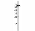Western blot analysis of CD105 antibody and mouse heart tissue lysate. Observed molecular weight: 70/90 kDa (monomer, unmodified/glycosylated); 140-180 kDa (dimer, unmodified/glycosylated).