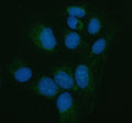 Immunofluorescent staining of PNLIP using anti-PNLIP antibody (green). PNLIP was detected in an immunocytochemical section of U2OS cells. Enzyme antigen retrieval was performed using IHC enzyme antigen retrieval reagent for 15 mins. The cells were blocked with 10% goat serum. And then incubated with 5 ug/ml rabbit anti-PNLIP antibody overnight at 4oC. DyLight 488 Conjugated Goat Anti-Rabbit IgG was used as secondary antibody at 1:500 dilution and incubated for 30 min at 37oC.