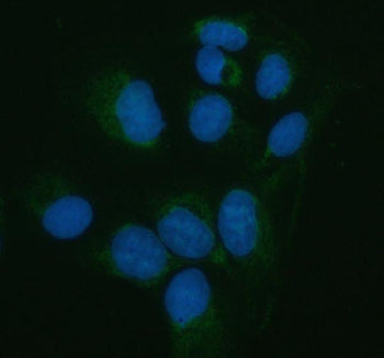 Immunofluorescent staining of PNLIP using anti-PNLIP antibody (green). PNLIP was detected in an immunocytochemical section of U2OS cells. Enzyme antigen retrieval was performed using IHC enzyme antigen retrieval reagent for 15 mins. The cells were blocked with 10% goat serum. And then incubated with 5 ug/ml rabbit anti-PNLIP antibody overnight at 4oC. DyLight 488 Conjugated Goat Anti-Rabbit IgG was used as secondary antibody at 1:500 dilution and incubated for 30 min at 37oC.