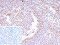 IHC staining of FFPE human tonsil tissue with CDK4 antibody (clone CDK4/8210R). Inset: PBS used in place of primary Ab (secondary Ab negative control). HIER: boil tissue sections in pH 9 10mM Tris with 1mM EDTA for 20 min and allow to cool before testing.