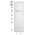 Western blot testing of human 1) HeLa and 2) A549 cell lysate with KLF5 antibody. Expected molecular weight: 41-51 kDa (two isoforms).