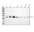 Western blot analysis of SYNJ2BP using anti-SYNJ2BP antibody. Lane 1: human RT4 whole cell lysates, Lane 2: human MCF-7 whole cell lysates, Lane 3: human PC-3 whole cell lysates, Lane 4: rat brain tissue lysates, Lane 5: rat heart tissue lysates, Lane 6: mouse brain tissue lysates, Lane 7: mouse heart tissue lysates. After electrophoresis, proteins were transferred to a nitrocellulose membrane at 150 mA for 50-90 min. Blocked the membrane with 5% non-fat milk/TBS for 1.5 hour at RT.
