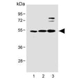 Western blot testing of human 1) U-2 OS, 2) SH-SY5Y and 3) MOLT4 cell lysate with LYK5 antibody. Predicted molecular weight ~48 kDa.