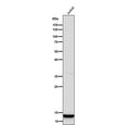 Western blot testing of human Jurkat cell lysate using the Histone H4 (mono methyl K20) antibody at 1:3000 dilution for 1 hour at room temperature. Predicted molecular weight ~11 kDa.