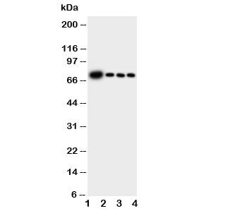 Western blot testing of GCLC antibody and Lane 1: rat brain; 2: rat kidney; 3: rat heart; 4: rat lung tissue lysate