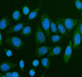 Immunofluorescent staining of TMEM232 using anti-TMEM232 antibody (green). TMEM232 was detected in an immunocytochemical section of human SiHa cells. Enzyme antigen retrieval was performed using IHC enzyme antigen retrieval reagent for 15 mins. The cells were blocked with 10% goat serum. And then incubated with 5 ug/ml rabbit anti-TMEM232 antibody overnight at 4oC. DyLight 488 Conjugated Goat Anti-Rabbit IgG was used as secondary antibody at 1:500 dilution and incubated for 30 minutes at 37oC. The section w