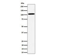 Western blot testing of human HepG2 cell lysate with USO1 antibody. Predicted molecular weight: ~108 kDa, routinely observed at 108~115 kDa.