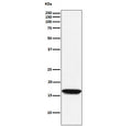 Western blot testing of human Jurkat cell lysate with NME1 antibody. Predicted molecular weight ~17 kDa.