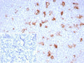 IHC staining of FFPE human tonsil tissue with SPARC antibody (clone OSTN/8528R). Inset: PBS used in place of primary Ab (secondary Ab negative control). HIER: boil tissue sections in pH 9 10mM Tris with 1mM EDTA for 20 min and allow to cool before testing.