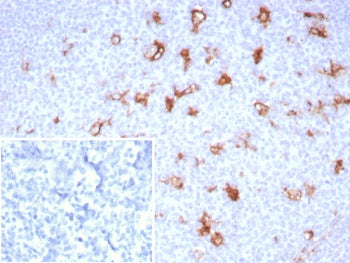 IHC staining of FFPE human tonsil tissue with SPARC antibody (clone OSTN/8528R). Inset: PBS used in place of primary Ab (secondary Ab negative control). HIER: boil tissue sections in pH 9 10mM Tris with 1mM EDTA for 20 min and allow to cool before testing.